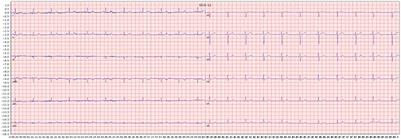 Image based deep learning in 12-lead ECG diagnosis